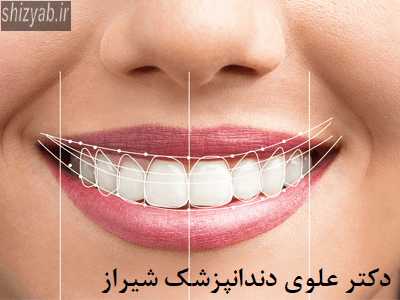 دکتر علوی دندانپزشک شیراز