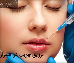 تزریق چربی در شیراز