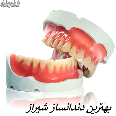 بهترین دندانساز شیراز