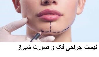 لیست جراحی فک و صورت شیراز