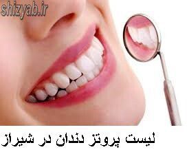 لیست پروتز دندان در شیراز