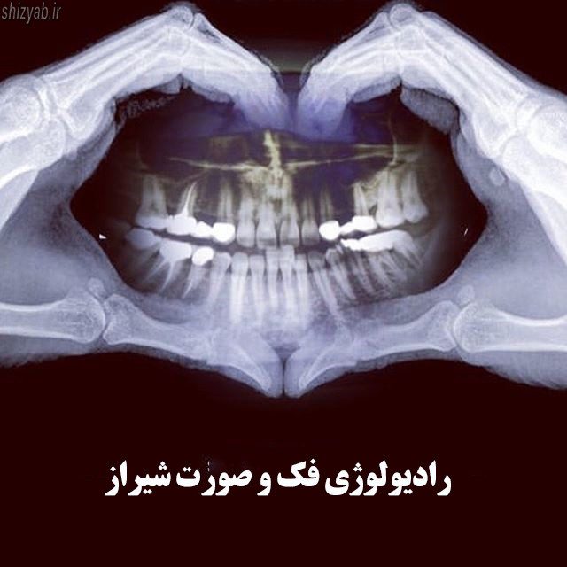 رادیولوژی فک و صورت در شیراز