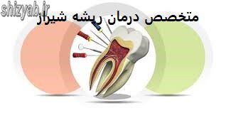 متخصص درمان ریشه شیراز