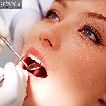 دندانپزشکی خوب در تهران