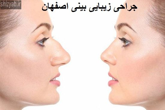 جراحی زیبایی بینی اصفهان