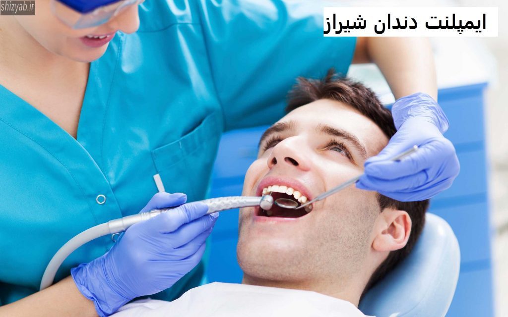 ایمپلنت دندان شیراز