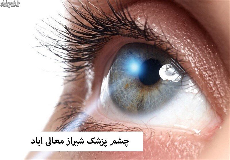 چشم پزشک شیراز معالی اباد