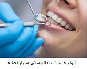 انواع خدمات دندانپزشکی شیراز تخفیف